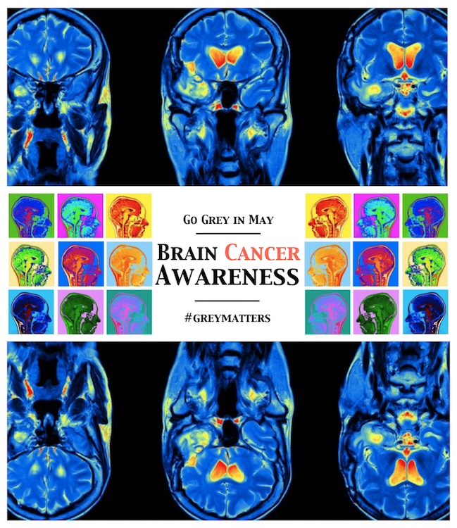 Brain Cancer Awareness Raise the Relm Go Grey in May Promo Tom Roderick Art